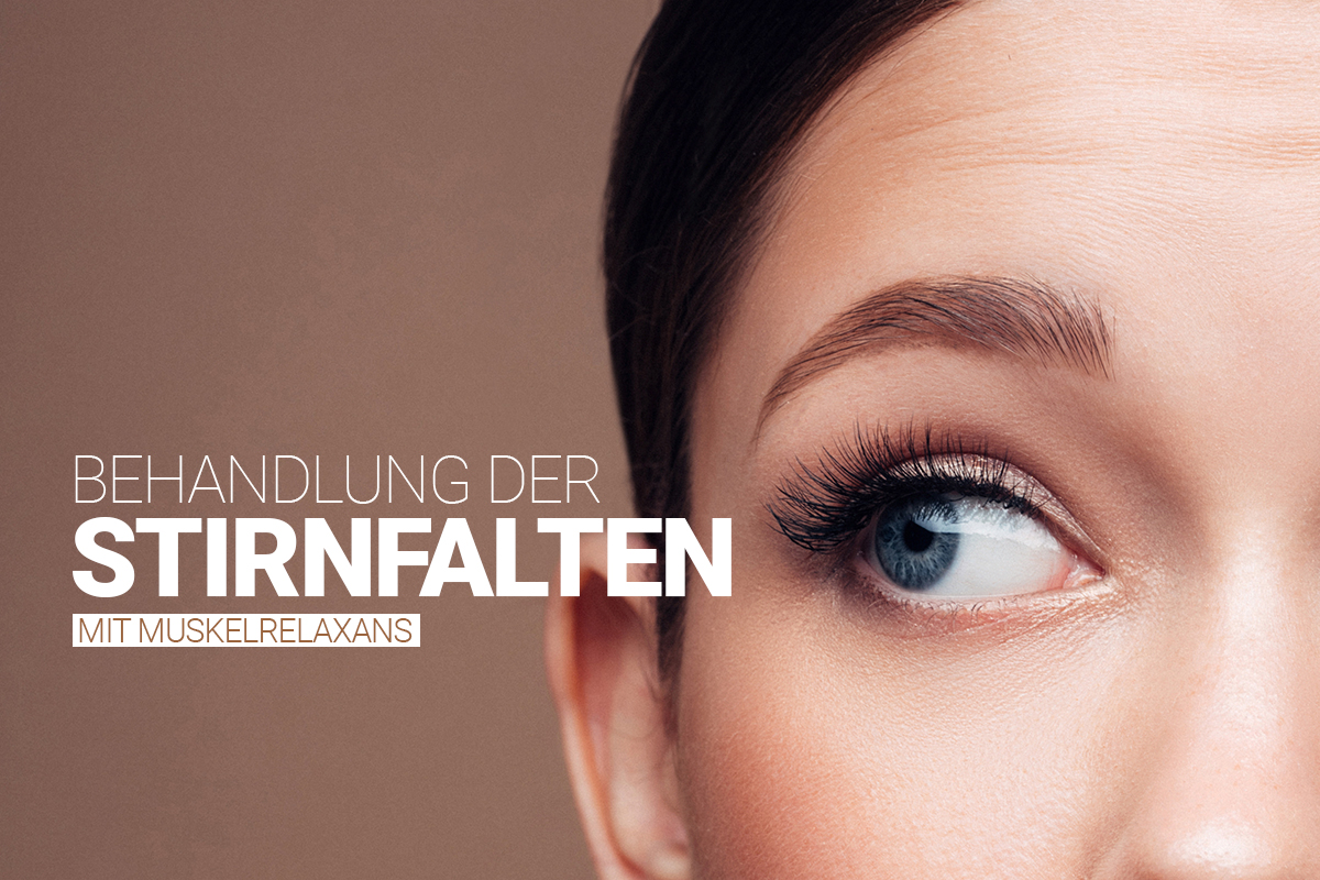 Stirnfaltenbehandlung mit Muskelrelaxans bei M1 Med Beauty Austria